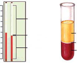 Cálculos del volumen sanguíneo